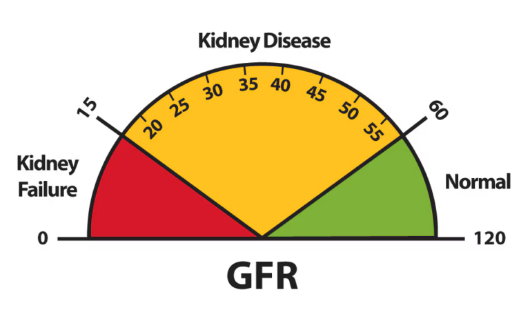 Low eGFR? What It Means & How to Protect Your Kidneys