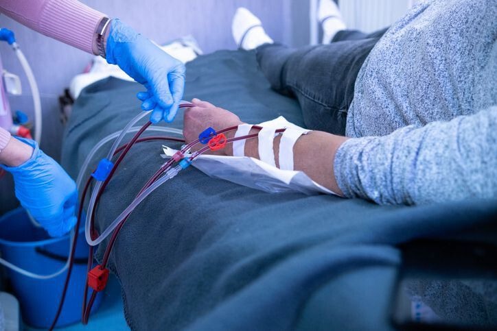 Dialysis Process