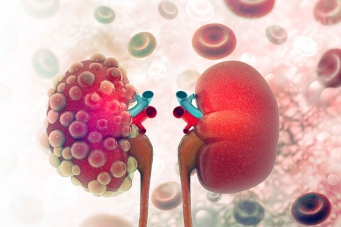 Kidney Tests